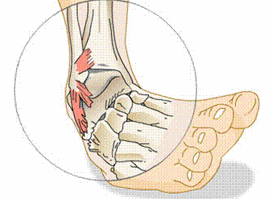 Chronic Ankle Instability (CAI) - Structura Body Therapies